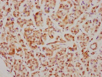 CDC5L Antibody (1E3)