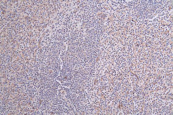 CD36 Antibody (13B12)