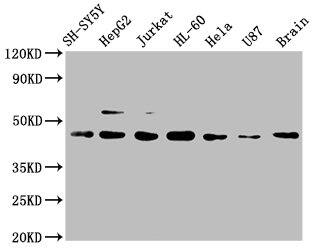 CCR9 Antibody (4G2)