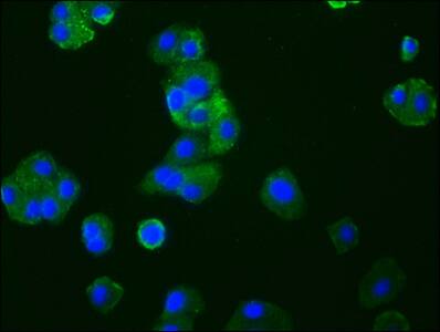 CCR9 Antibody (4G2)