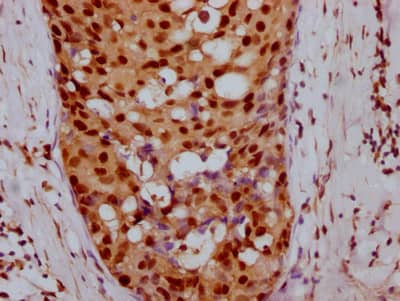 Cyclin E1 Antibody (3A5)