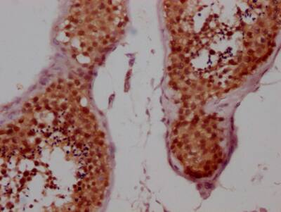 Cyclin E1 Antibody (3A5)