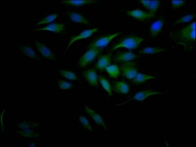 Cyclin E1 Antibody (9H12)