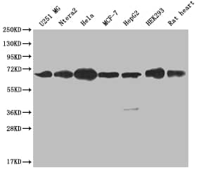 Cbx2 Antibody (24A2)