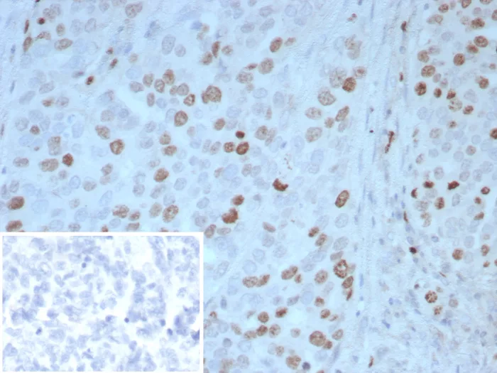 Pax4 Antibody (PAX4/7598)