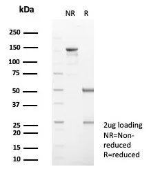 Serpin B5/Maspin Antibody (SERPINB5/4971)