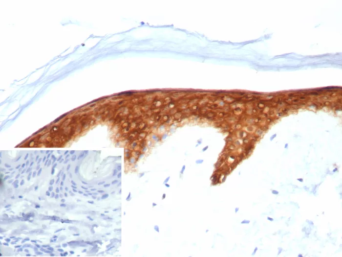 Serpin B5/Maspin Antibody (SERPINB5/4974)