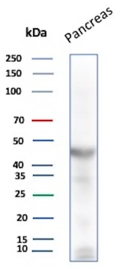 Pancreatic Lipase Antibody (PNLIP/8916)