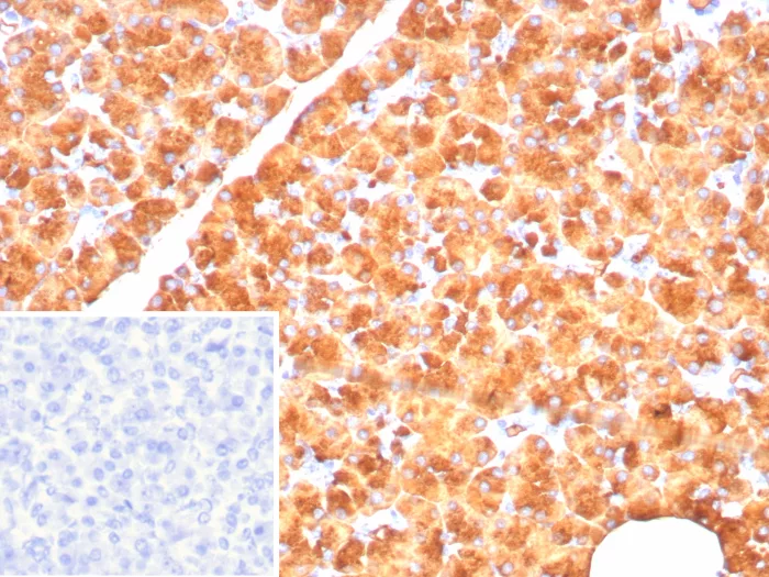 Pancreatic Lipase Antibody (PNLIP/8916)