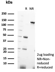 Parvalbumin alpha Antibody (PVALB/7601)