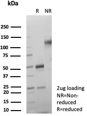 SDHA Antibody (SDHA/7491)