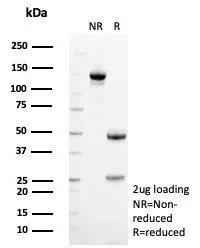 SDHA Antibody (SDHA/7492)