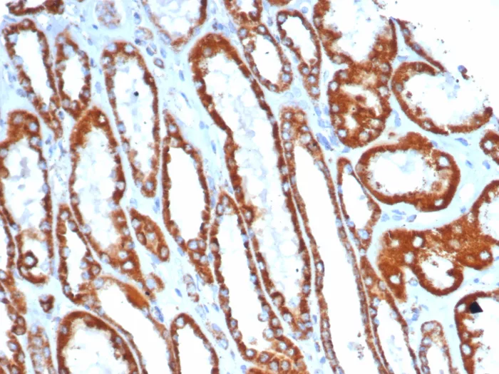 SDHA Antibody (SDHA/7493)