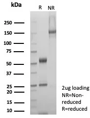 SDHA Antibody (SDHA/7495)