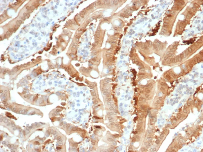 Cytosolic Sulfotransferase 1E1/SULT1E1 Antibody (SULT1E1/7124)