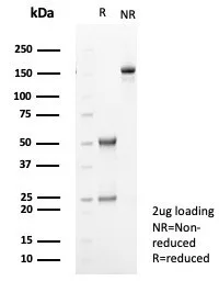 TGF-beta 2 Antibody (TGFB2/1679)