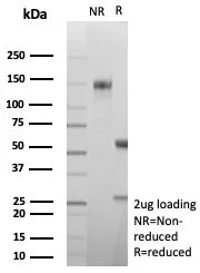 Carbonic Anhydrase VIII/CA8 Antibody (CA8/8605R)