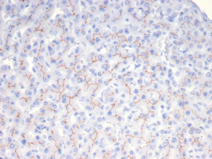 ABCB11 Antibody (BSEP/7534)