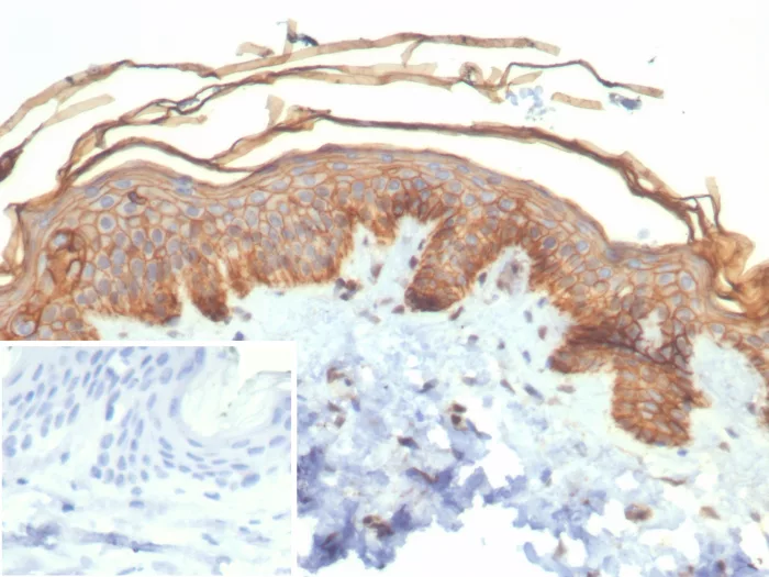 S100A16 Antibody (S100A16/7411)