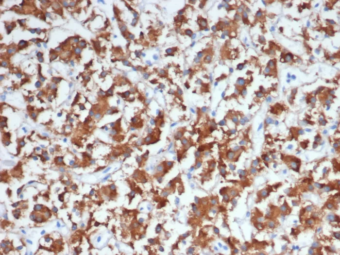 Dopamine beta-Hydroxylase Antibody (DBH/7224)