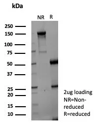 Aldo-keto Reductase 1C1/AKR1C1 Antibody (AKR1C1/9070)