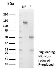 SNW1 Antibody (PCRP-SNW1-2A1)