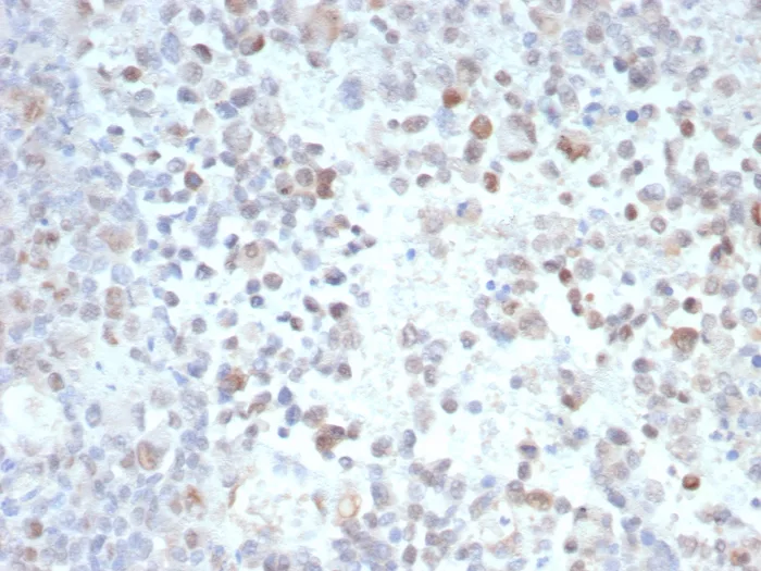 PRAME Antibody (PRAME/9189)