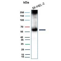 PRAME Antibody (PRAME/9189) Western Blot: PRAME Antibody (PRAME/9189) [NBP3-26784] -