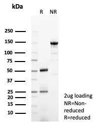 GCHFR Antibody (GCHFR/7731)