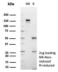 GCHFR Antibody (GCHFR/7732)