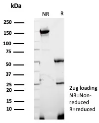 GBP1 Antibody (GBP1/7618)