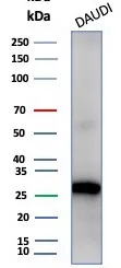Haptoglobin Antibody (HP/4813)