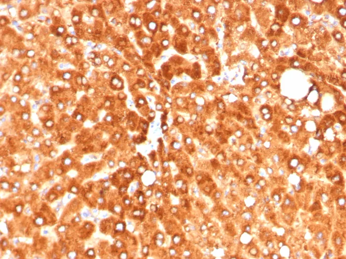 Haptoglobin Antibody (HP/4813)