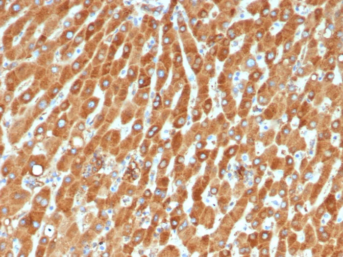 Haptoglobin Antibody (HP/4815)