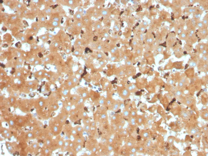 Haptoglobin Antibody (HP/3832)