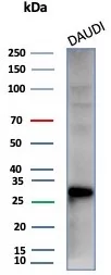 Haptoglobin Antibody (HP/3838)