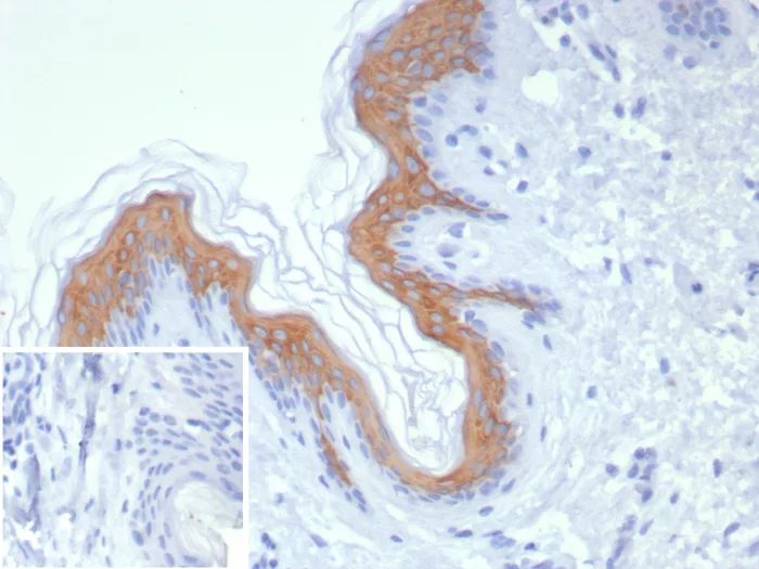 Cytokeratin 1 Antibody (KRT1/8342R)