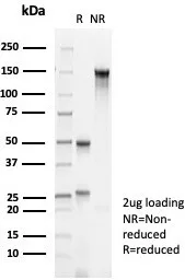 Cytokeratin 10 Antibody (KRT10/6961)