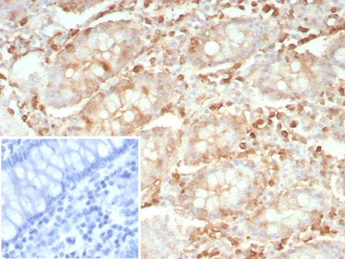 Stathmin 1 Antibody (rSTMN1/9255)