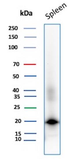 Stathmin 1 Antibody (STMN1/8012) Western Blot: Stathmin 1 Antibody (STMN1/8012) [NBP3-26812] -