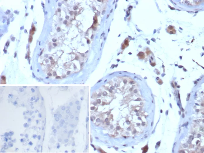 LHR Antibody (LHCGR/7398)