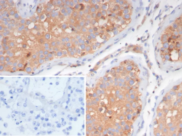 LHR Antibody (LHCGR/7399)