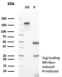 Mineralocorticoid R/NR3C2 Antibody (NR3C2/4900)