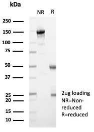 MxA/Mx1 Antibody (MX1/7529)