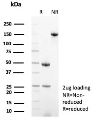 MxA/Mx1 Antibody (MX1/7530)