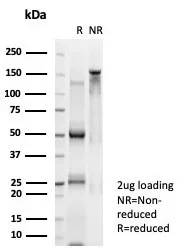 n-Myc Antibody (PCRP-MYCN-1A9)