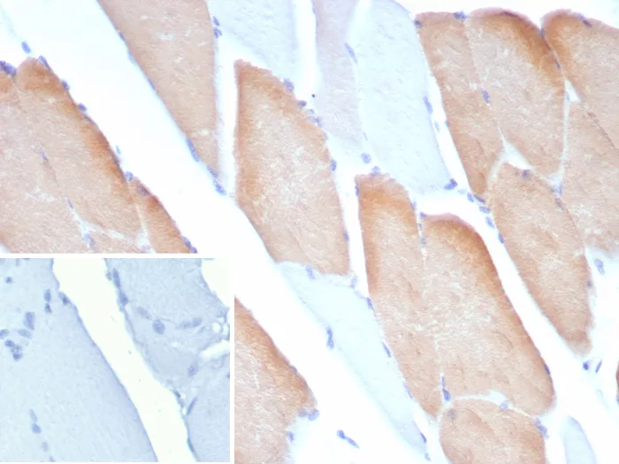 MYH7 Antibody (MYH7/9183)