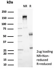 NM23-H2/NME2 Antibody (NME2/4160)