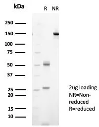 NM23-H2/NME2 Antibody (NME2/6434)