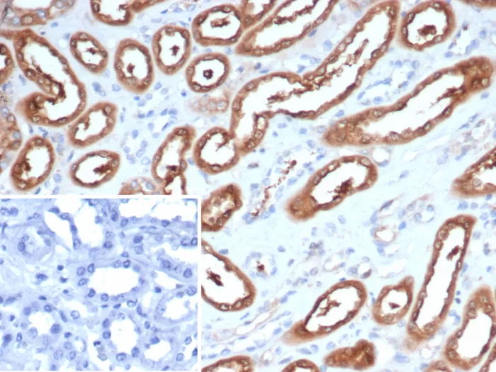 NM23-H2/NME2 Antibody (NME2/6437)